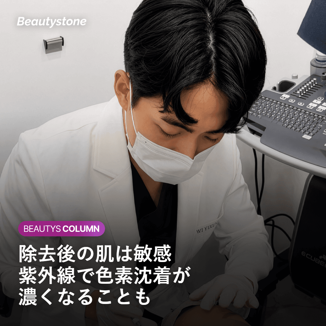 除去後の敏感な肌に紫外線が色素沈着を引き起こす仕組みのイメージ