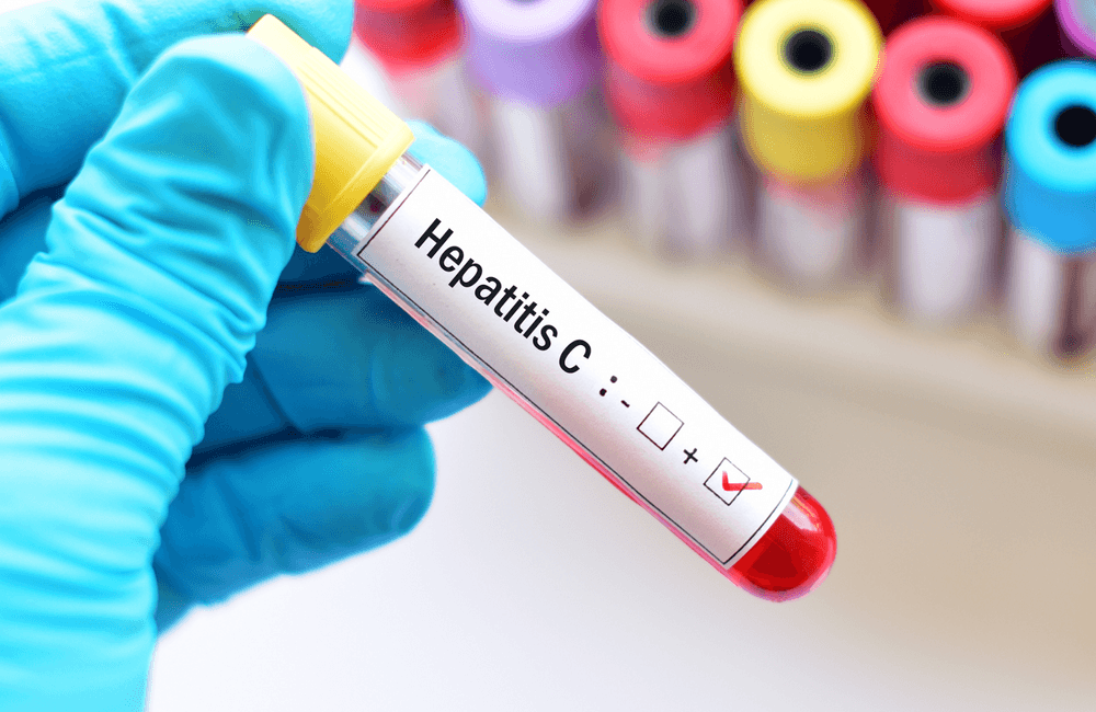 Hepatitis C test