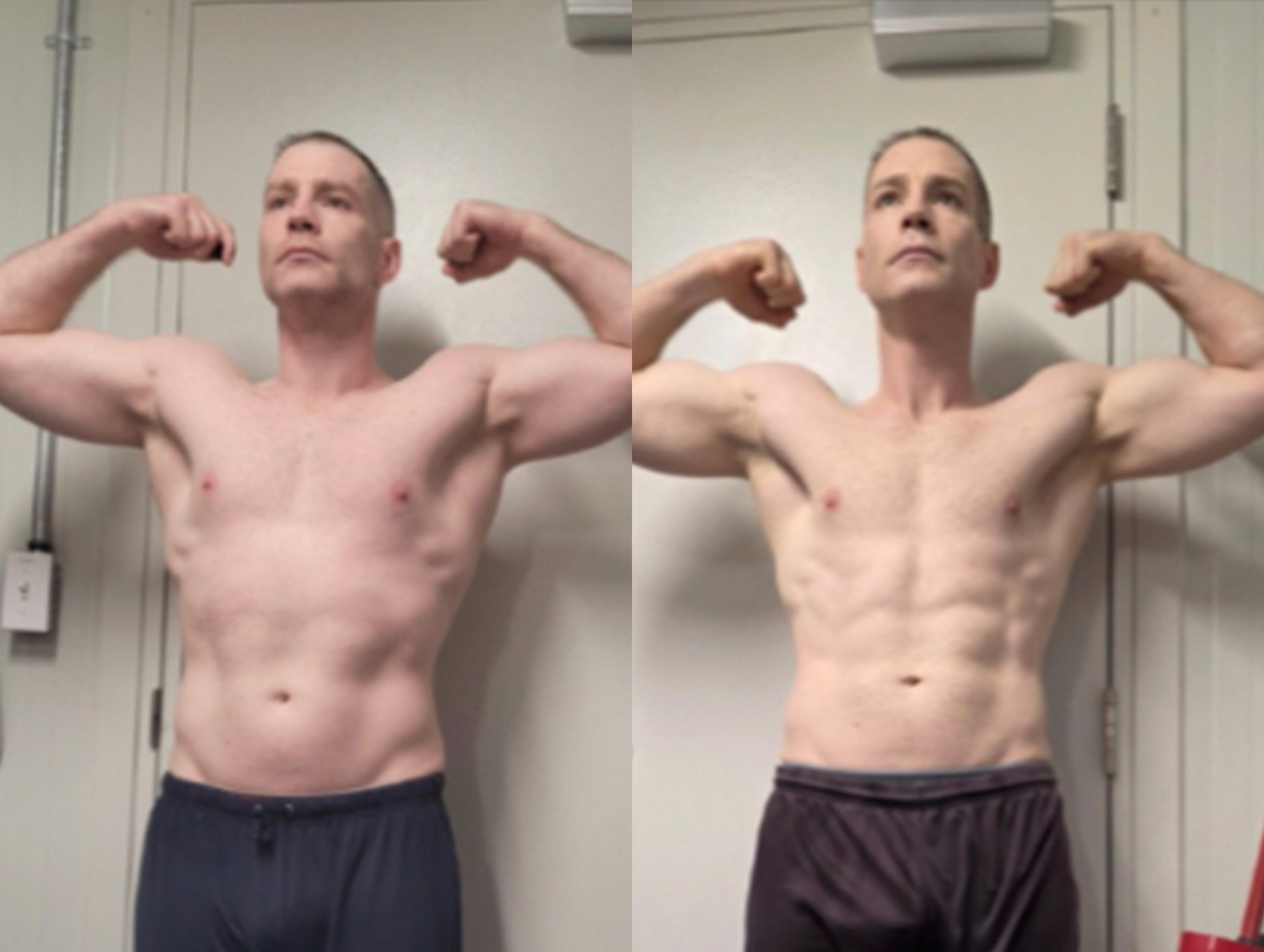 Randall R. before and after
