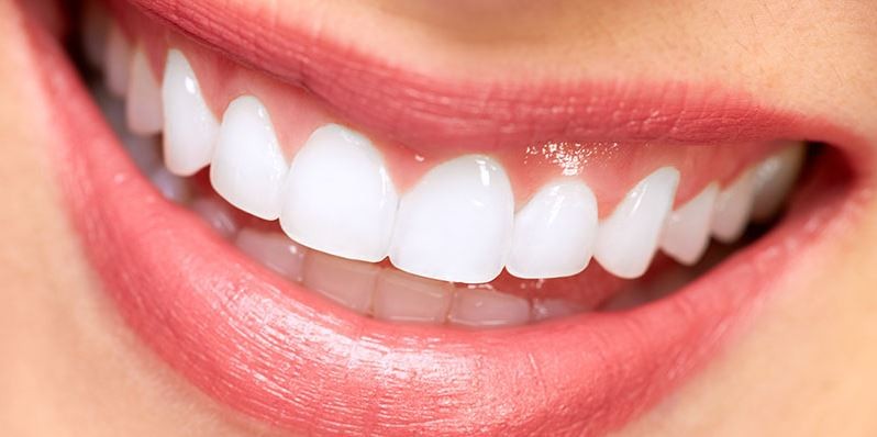 Smile Transformation