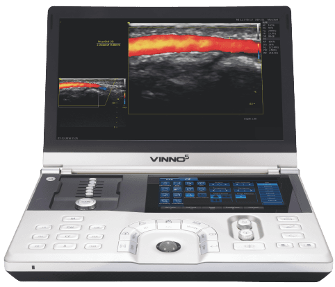Ultrsonido de la marca Vinno modelo 5