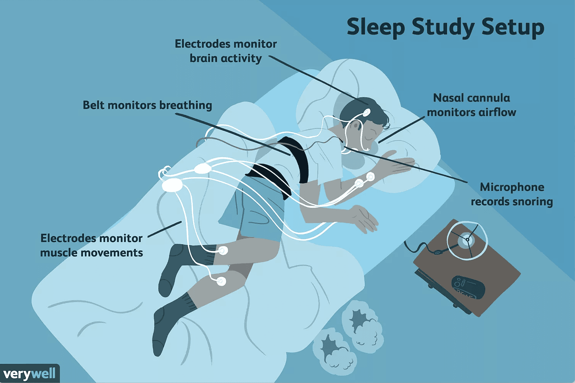 Polysomnography signals used for deep learning sleep stage classification