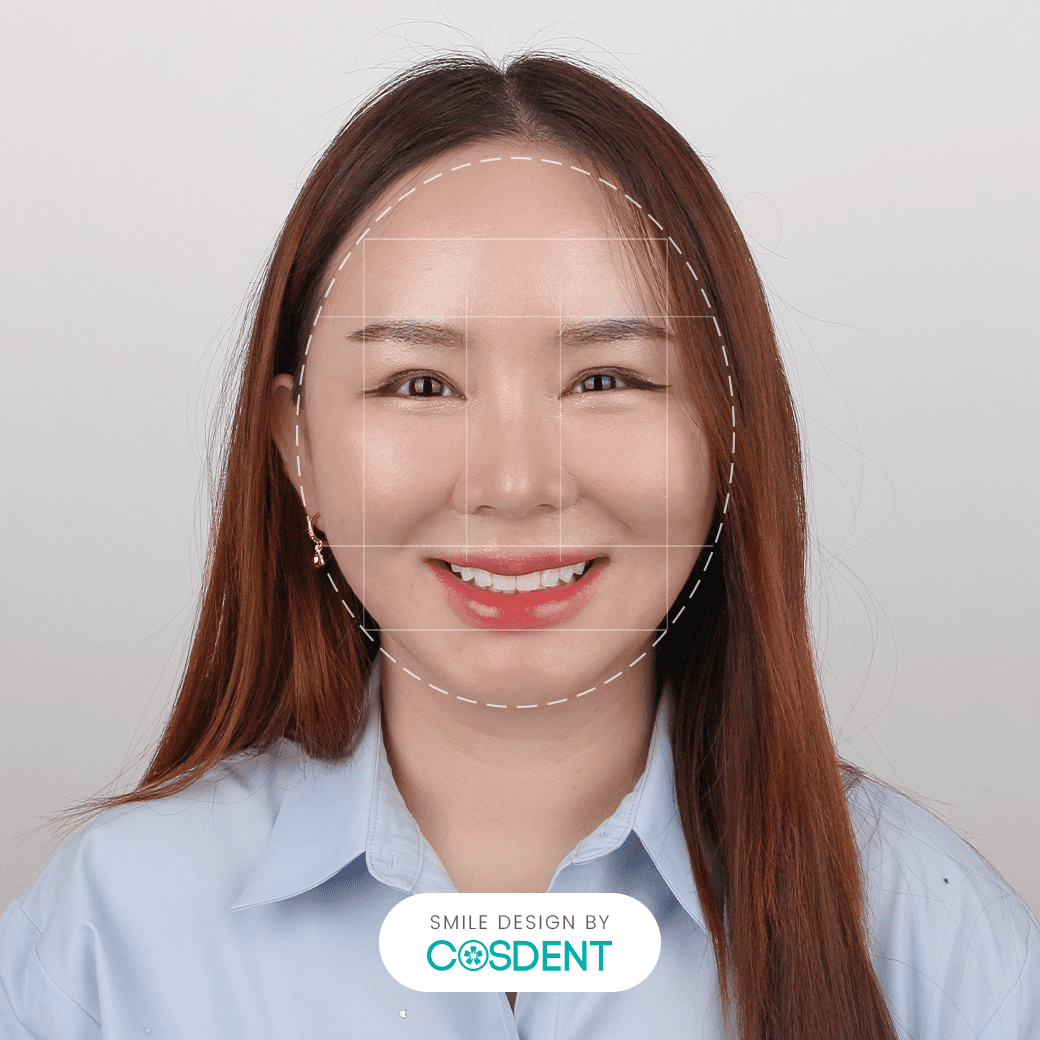 หน้ากลม ยิ้มกว้าง 16 ซี่