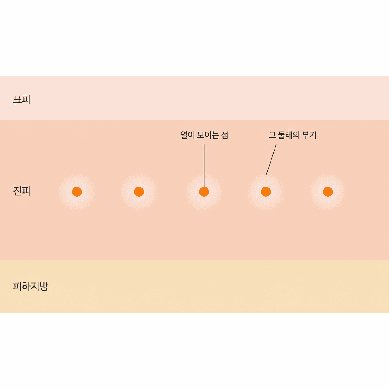 점처럼 흩어진 자리와 그 둘레의 부기가 손끝에 함께 걸려요.