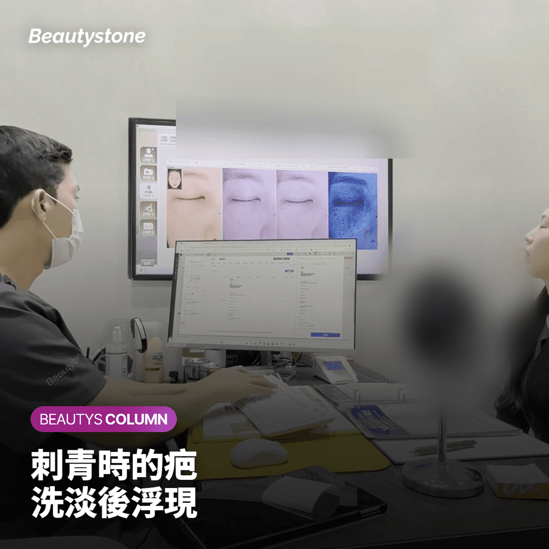 哪些情況下,雷射洗刺青比較容易留疤?