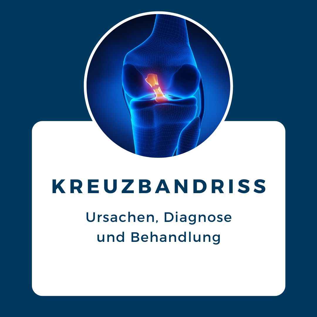 Kreuzbandriss Blog Vorschau
