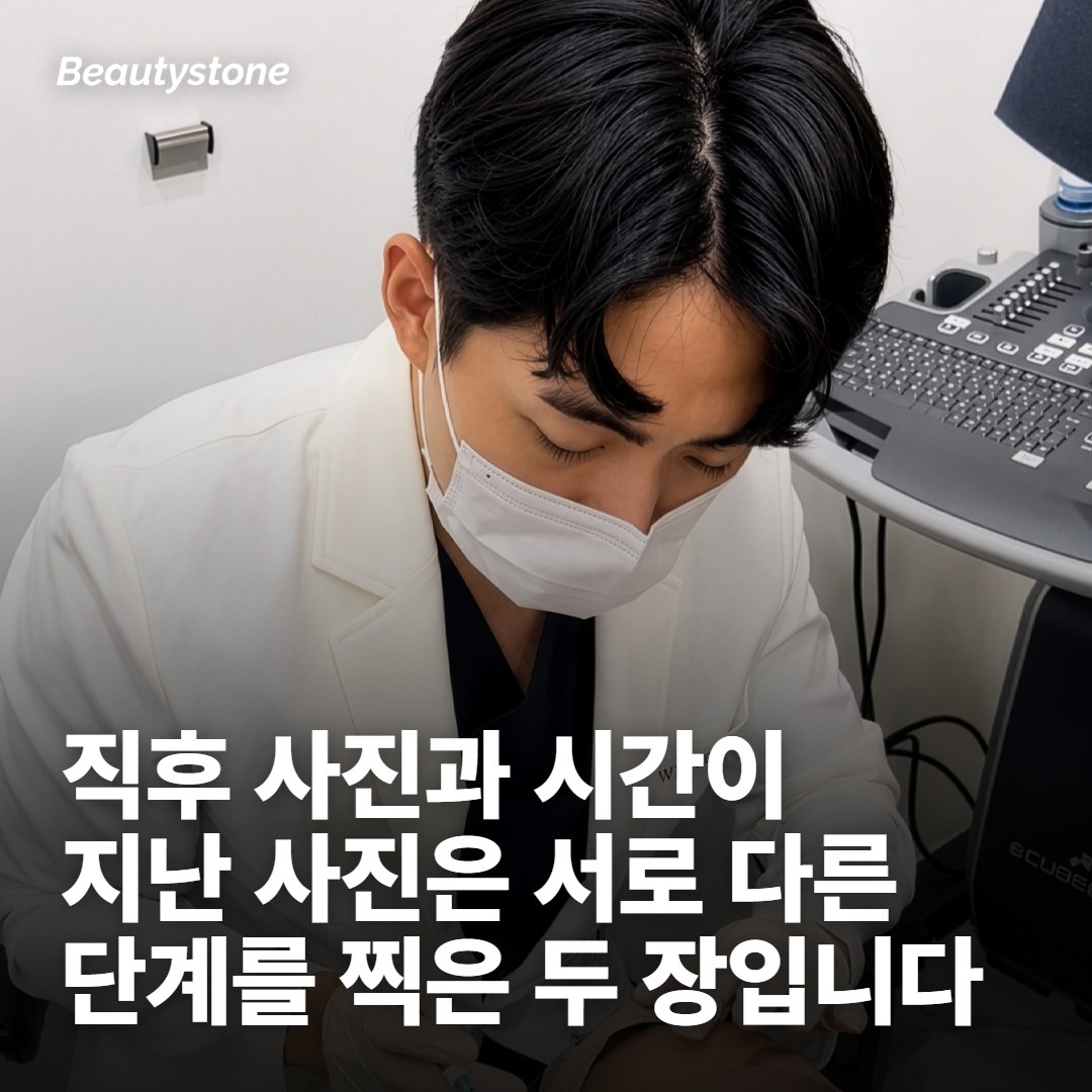 시점 - 며칠째 사진인지 적혀 있나요