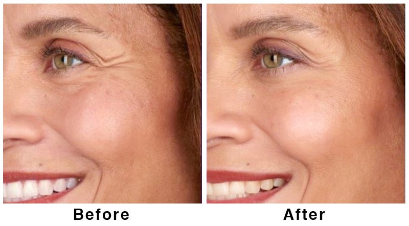 Before and after of surgery image