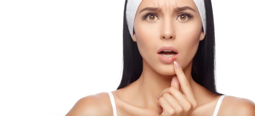 Herpes Labial: Desmistifique o vírus e saiba como prevenir!