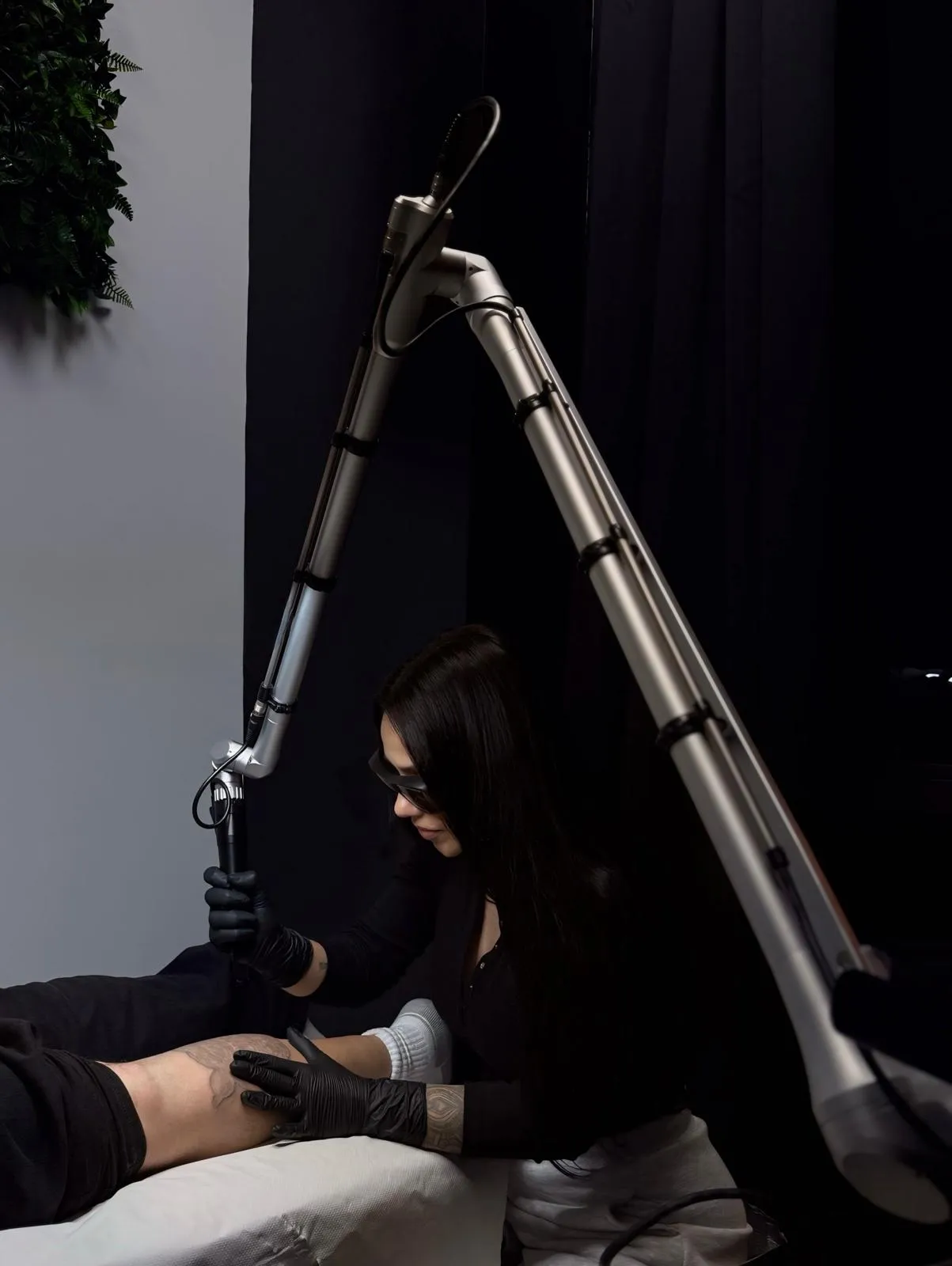 Eliminación de tatuajes con láser en Móstoles