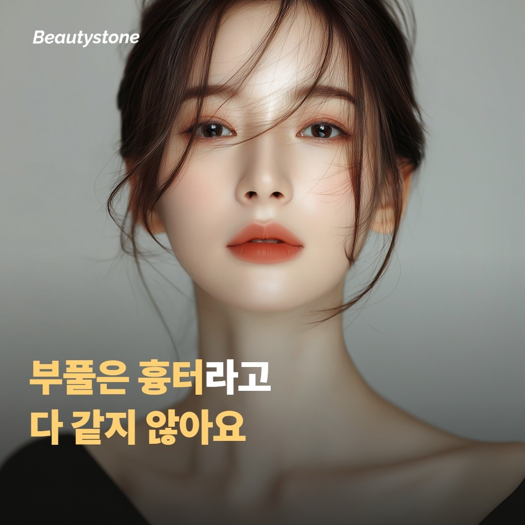 켈로이드와 비대성 흉터는 무엇이 다를까요