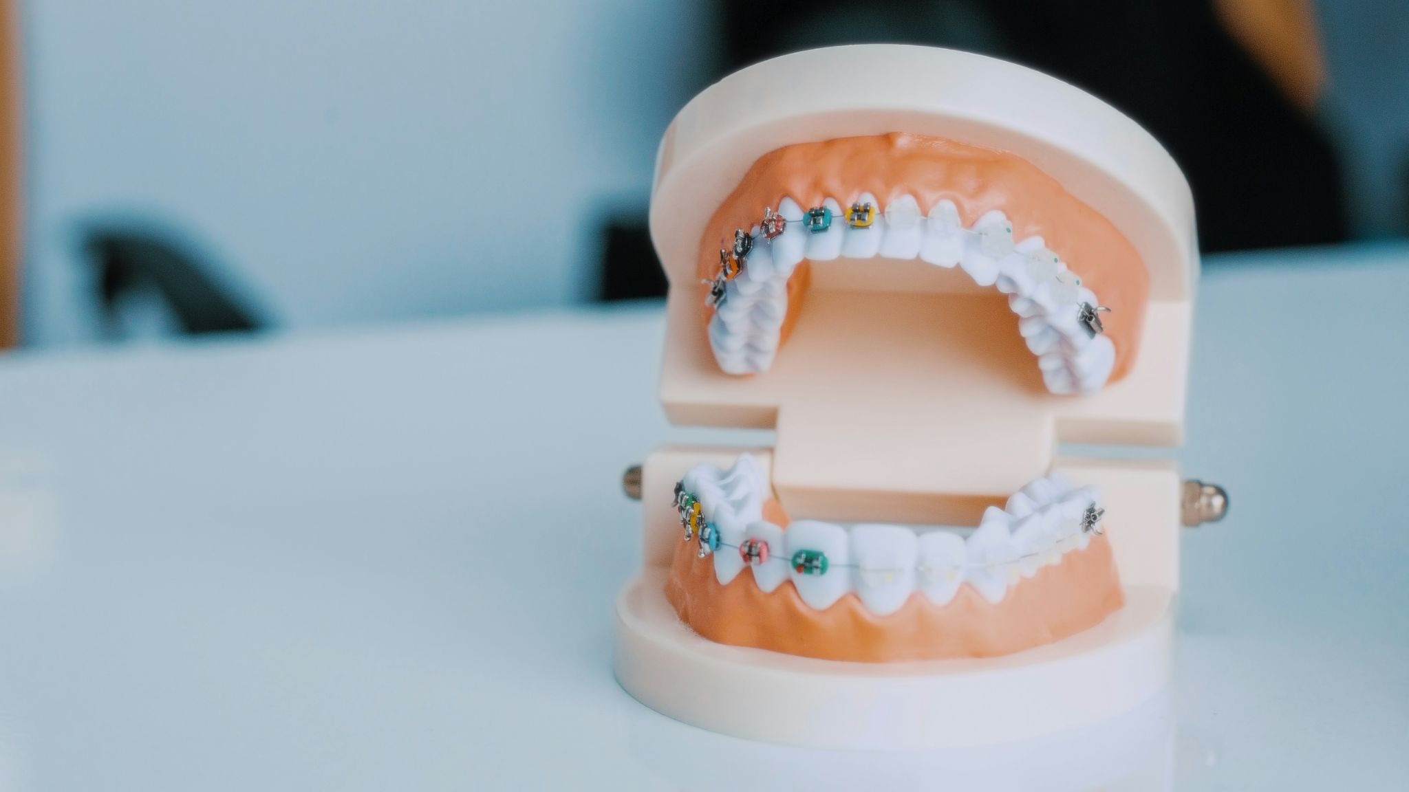Are Ceramic Braces the Right Choice for You?&nbsp;