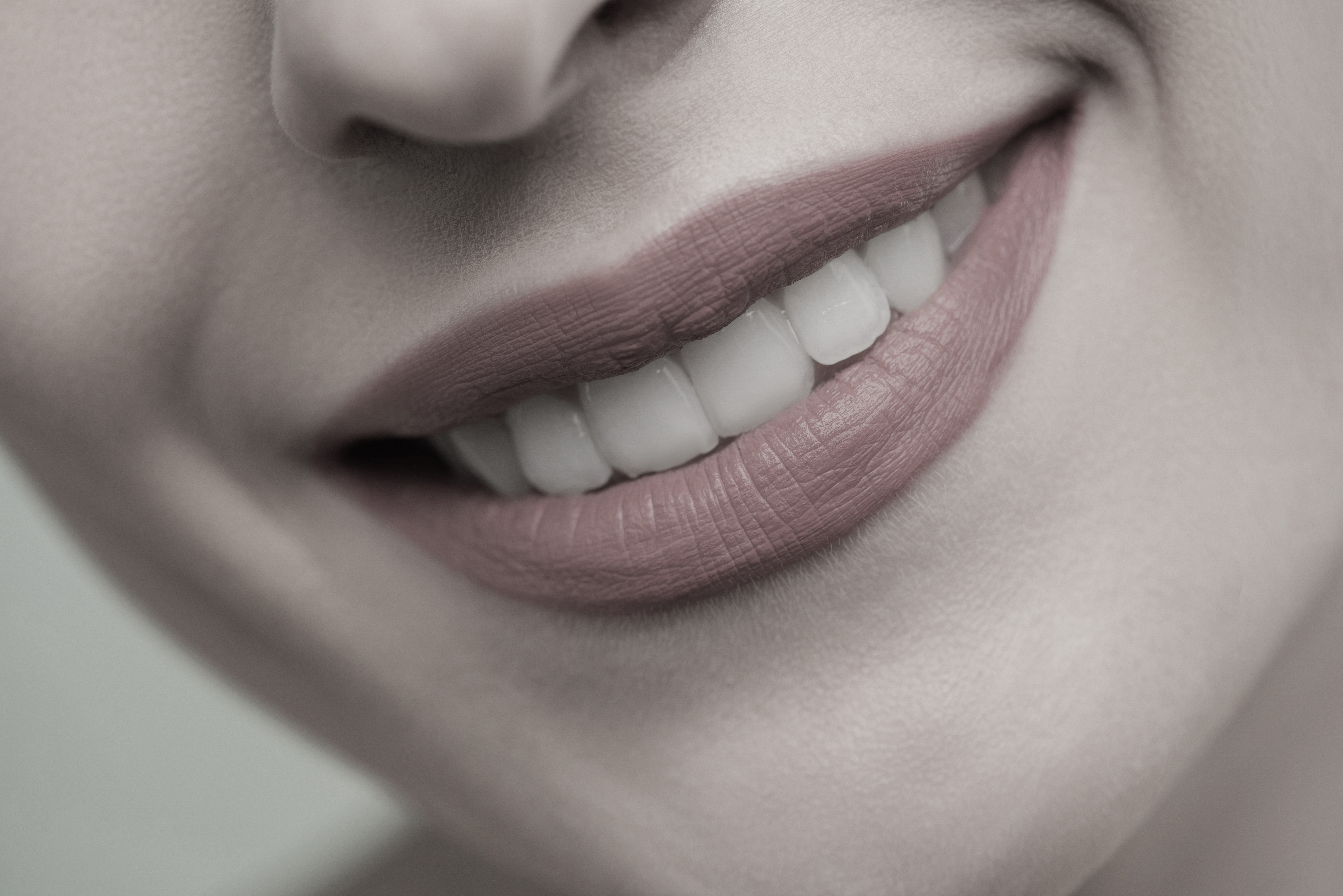 Dental whitening Colac