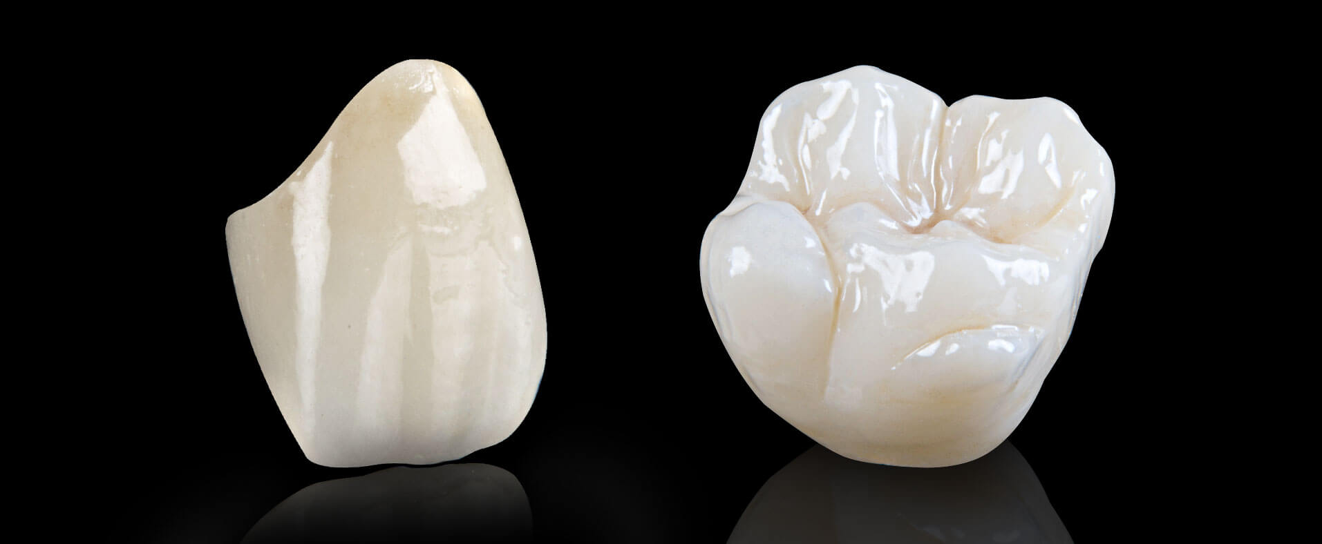 doctor in dental clinic davao matina showing porcelain fused to zirconia crown
