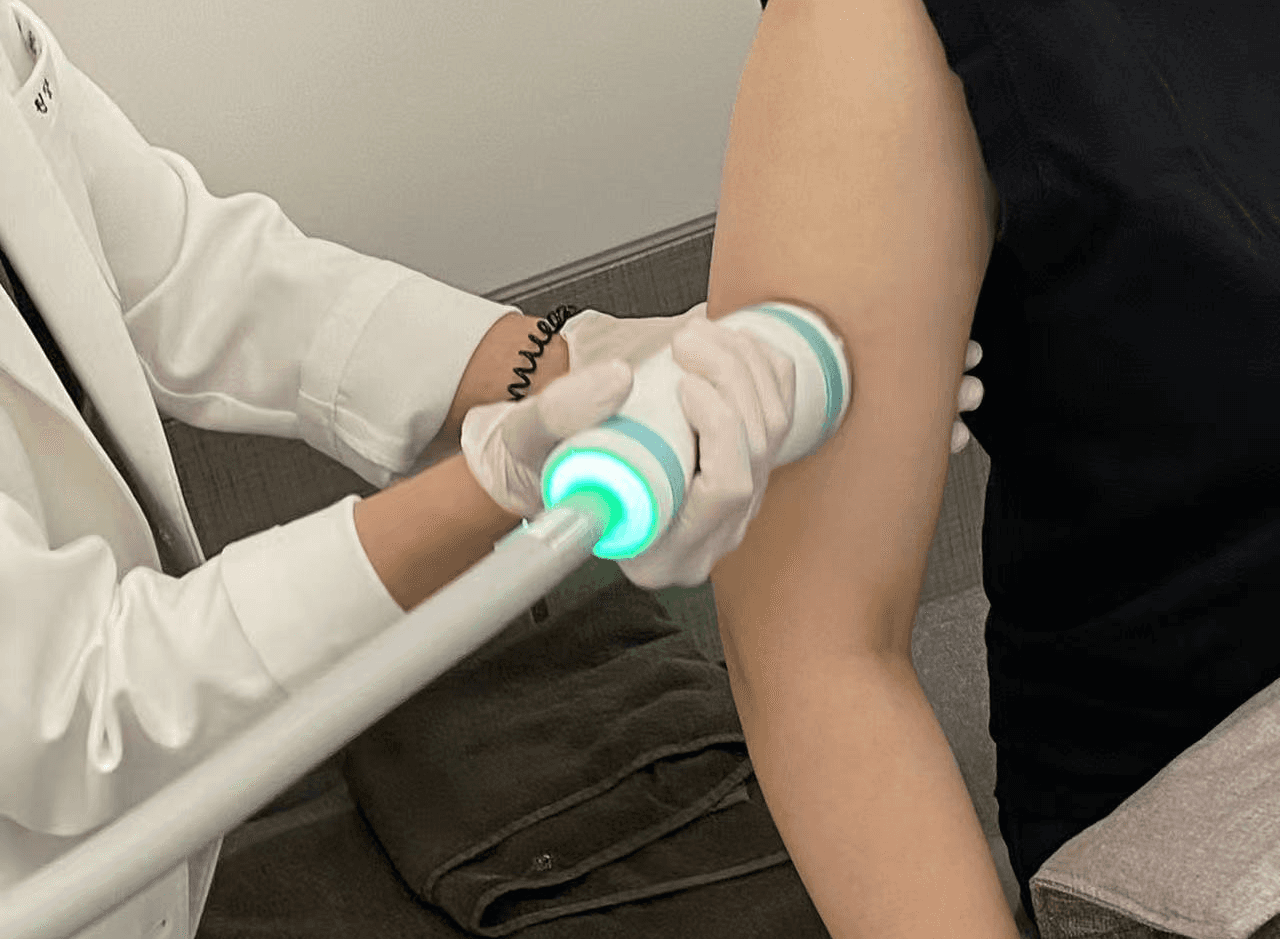 ONDA lifting treatment applied to patient's arm
