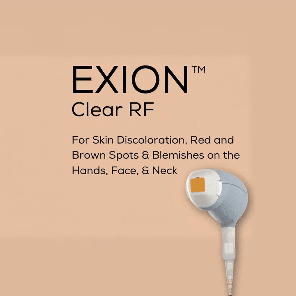 Exion Clear RF