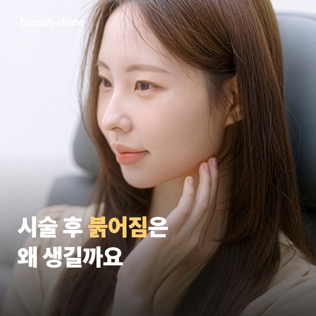 시술 후 붉어짐은 왜 생길까요