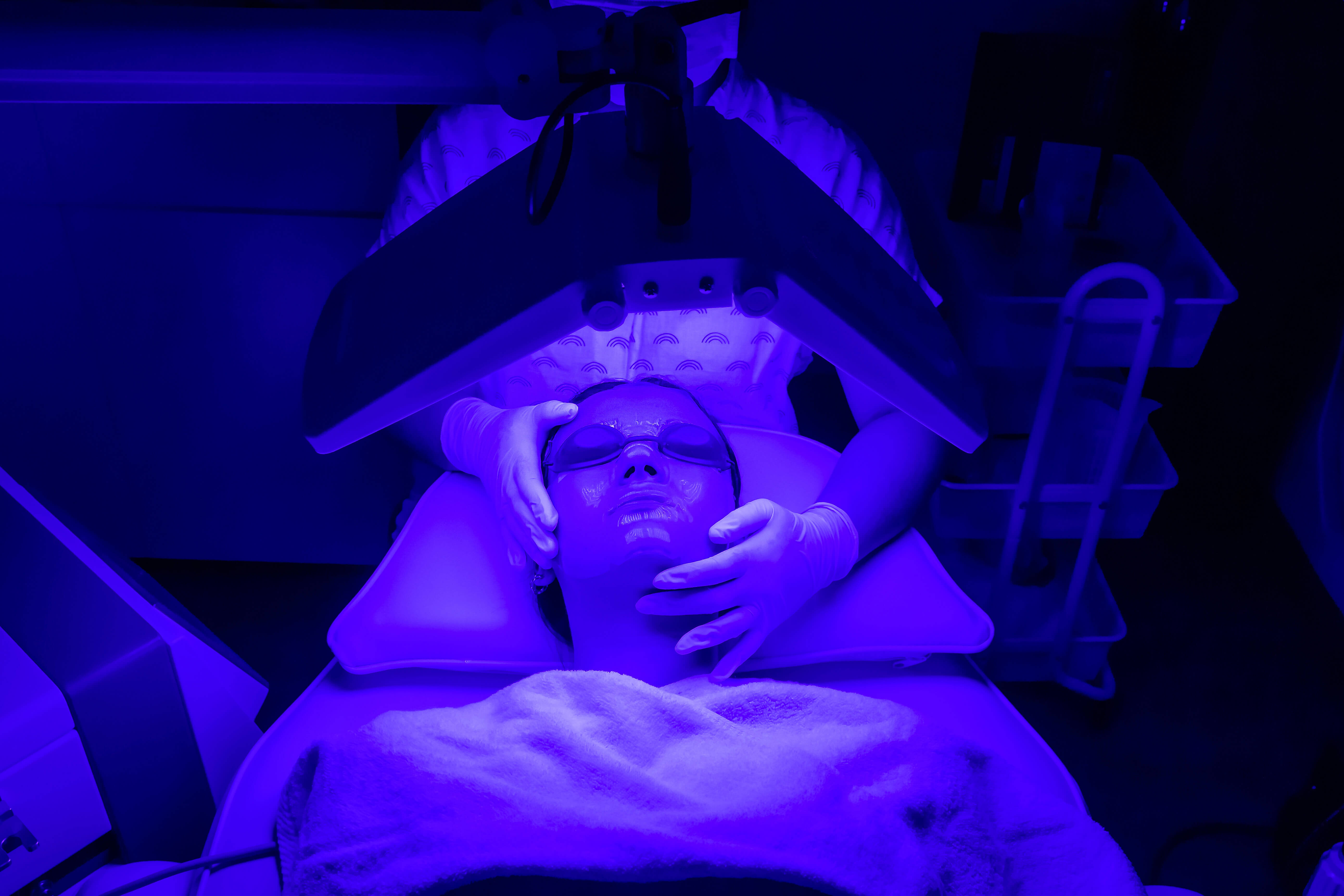 Zabieg fotodynamiczny z zastosowaniem specjalistycznego żelu FOTO Est Gen i światła.