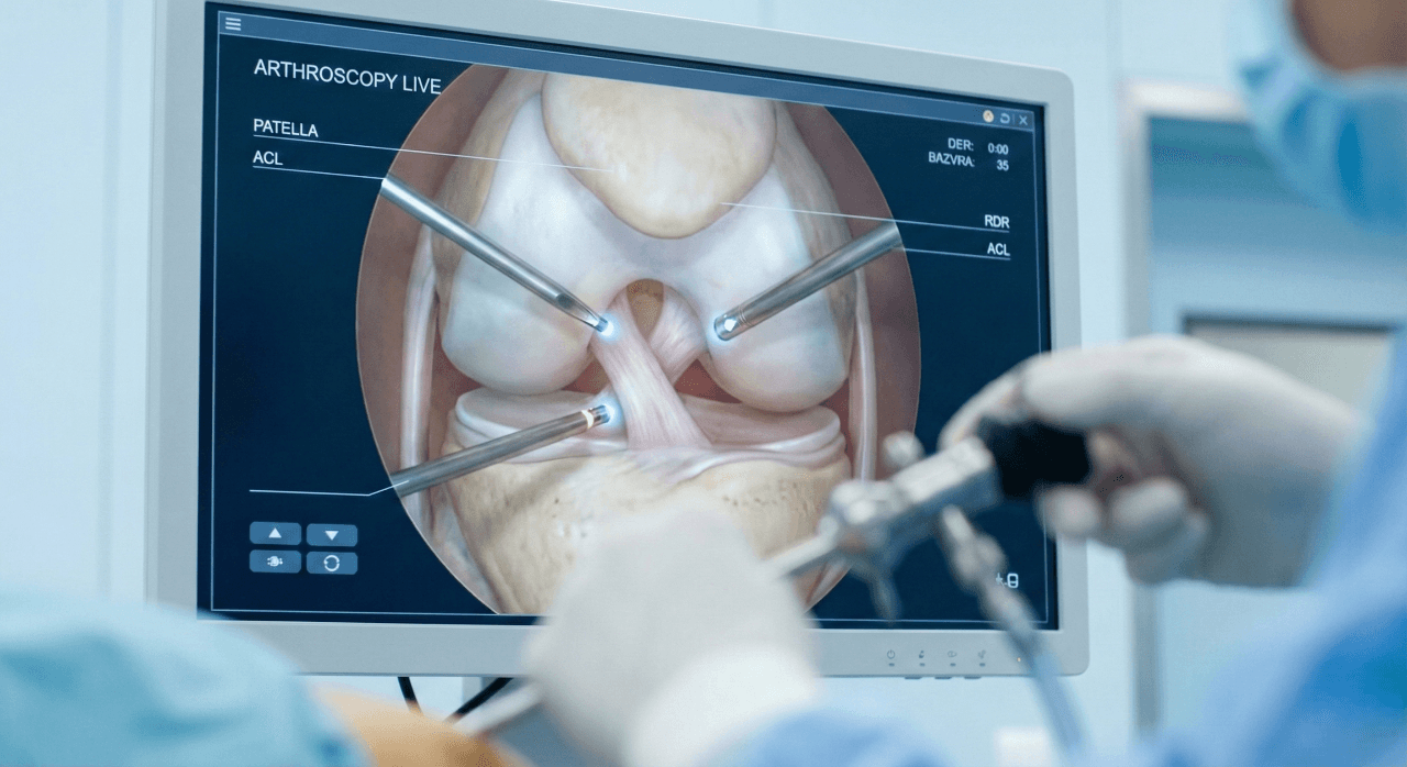Advanced knee arthroscopy in Dubai used for meniscus surgery and knee ligament repair
