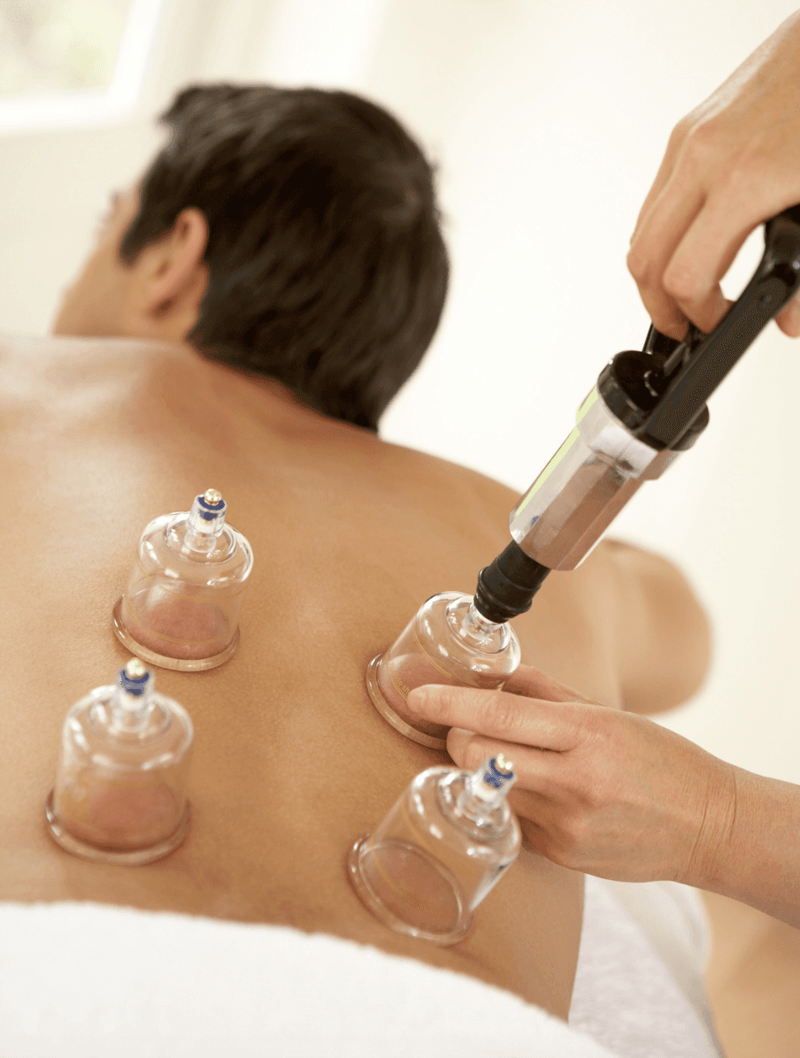 Cupping Thérapie