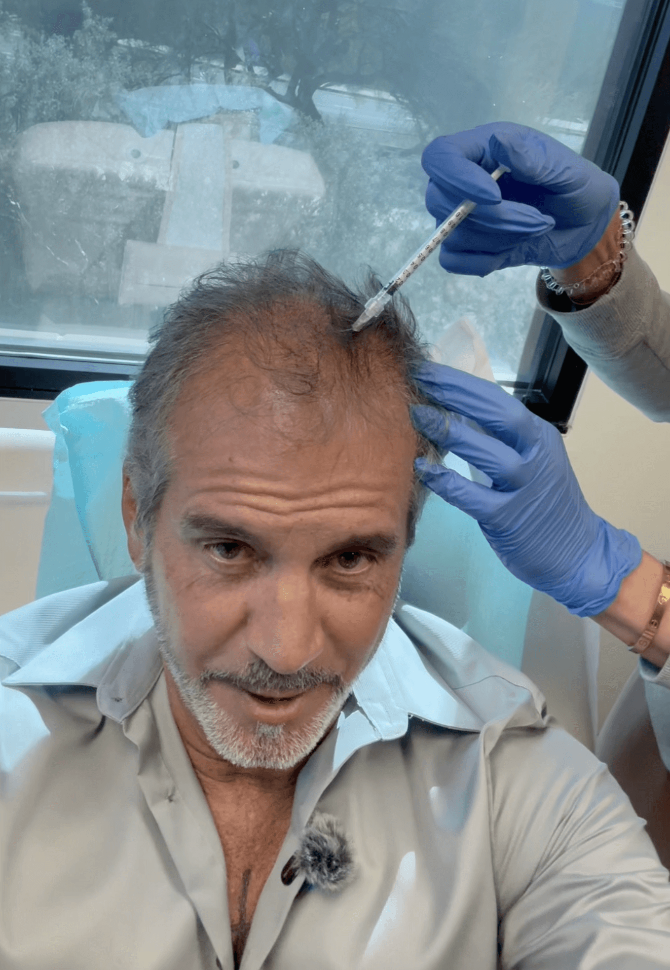Avera Aesthetics & Wellness Stem Cell Hair Restoration Photo