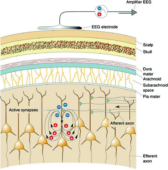 Electroencephalogram and it's background