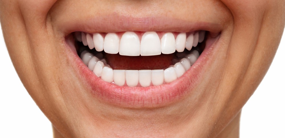 Fogászati esztétika előtte–utána – mosoly átalakítás
