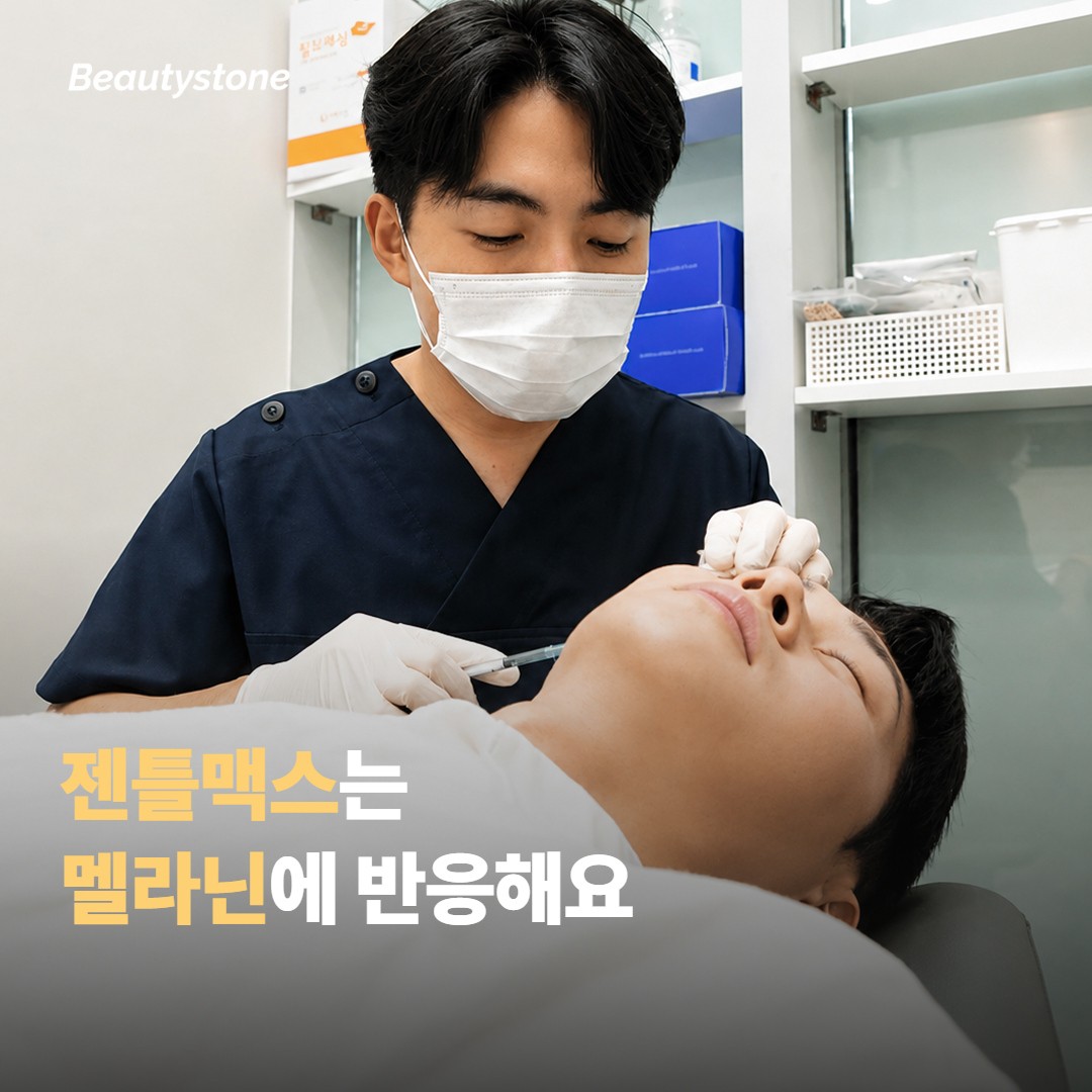 젠틀맥스는 얼굴 솜털에서 어떻게 작동할까요