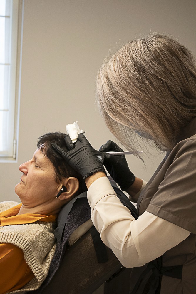 Haarlijn reconstructie