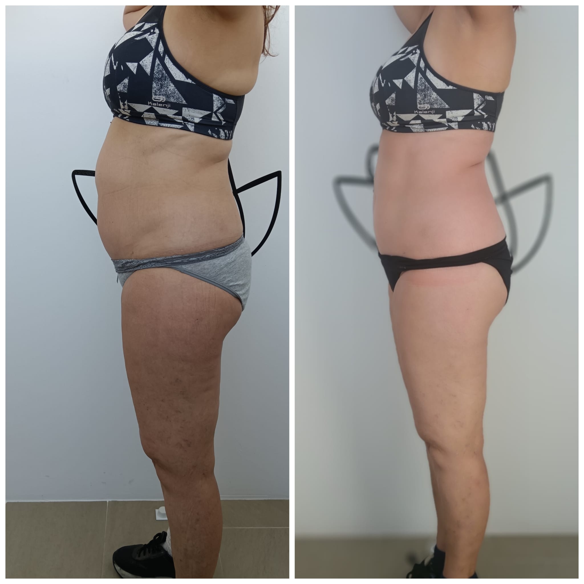 Transformation Photo