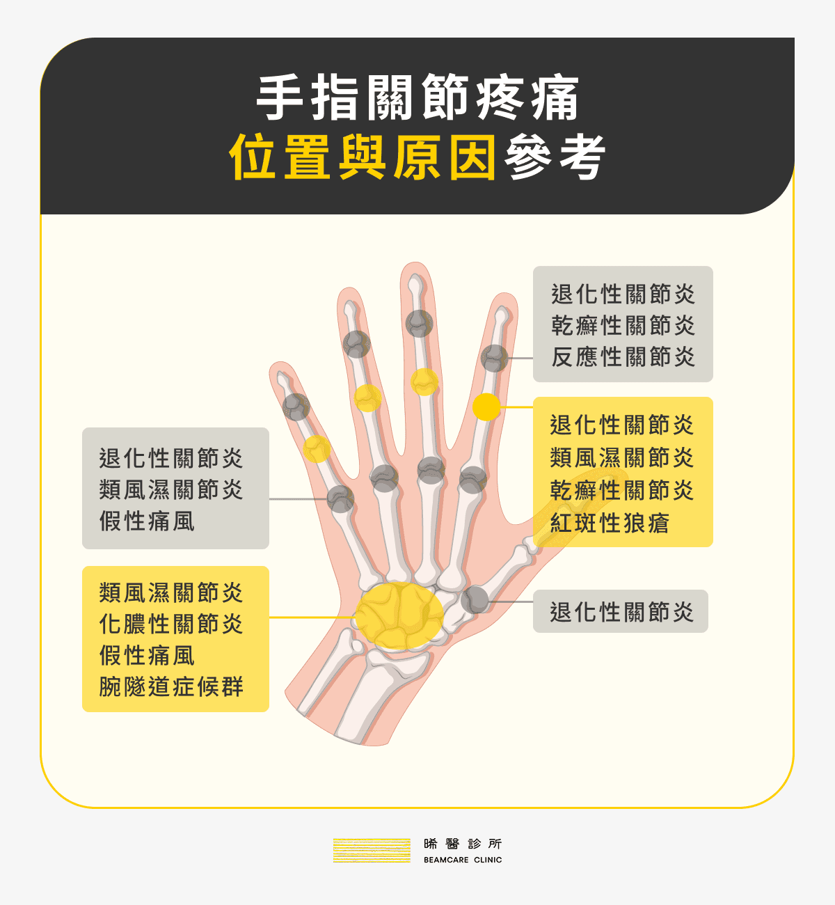 手指關節疼痛位置與原因參考