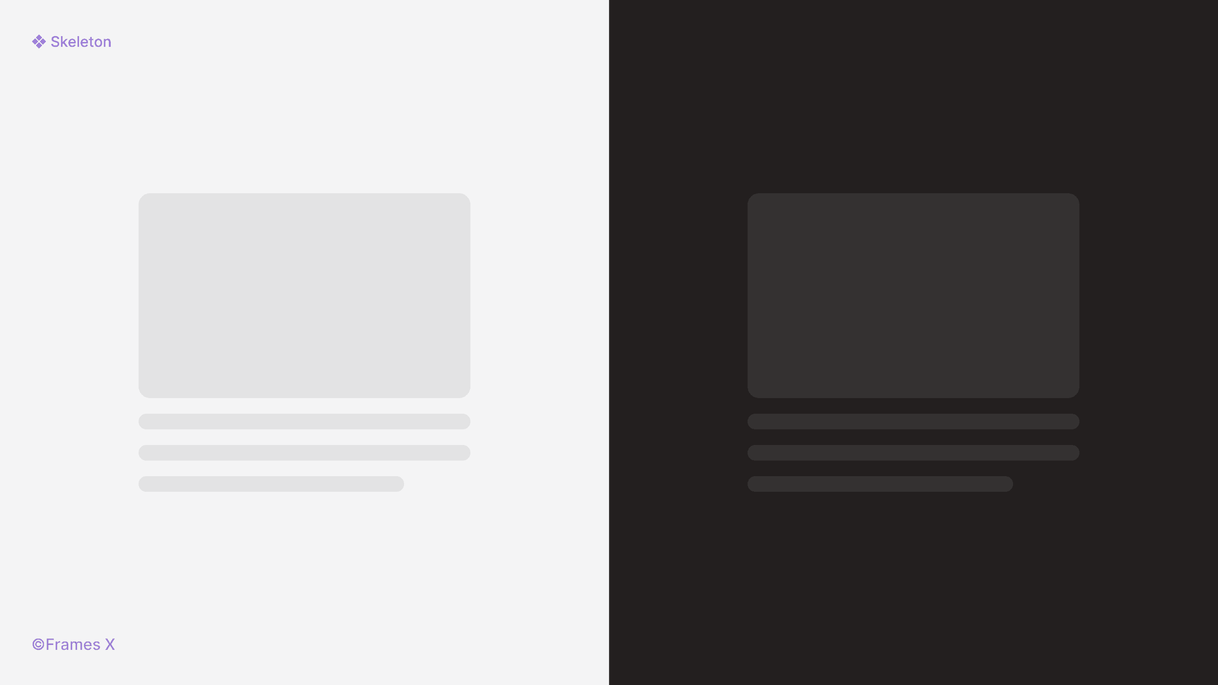 Interactive Skeleton UI Component for Figma