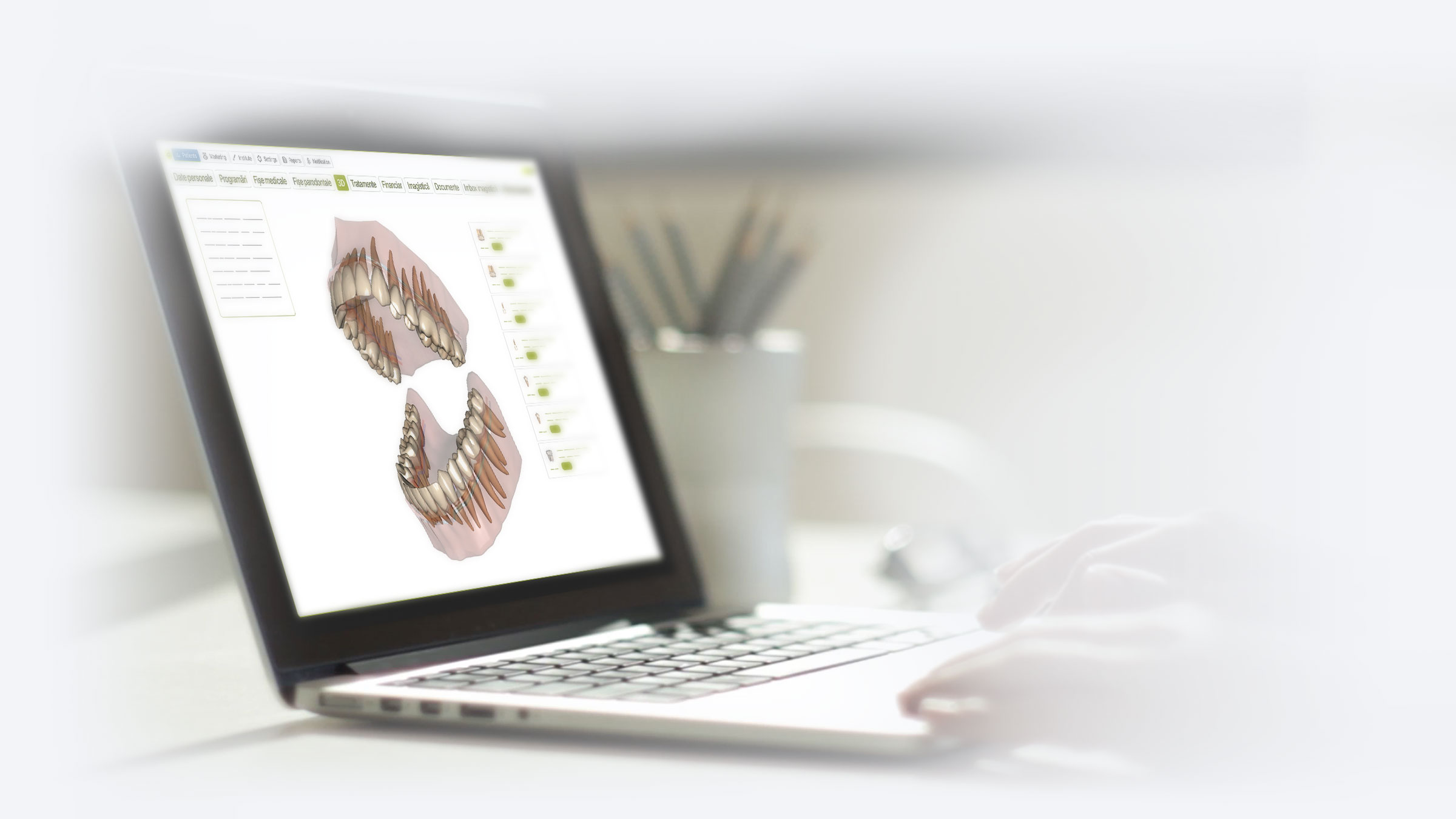 Vizualizare grafică 3D dentară pe tabletă, utilizând dROOT pentru planuri de tratament