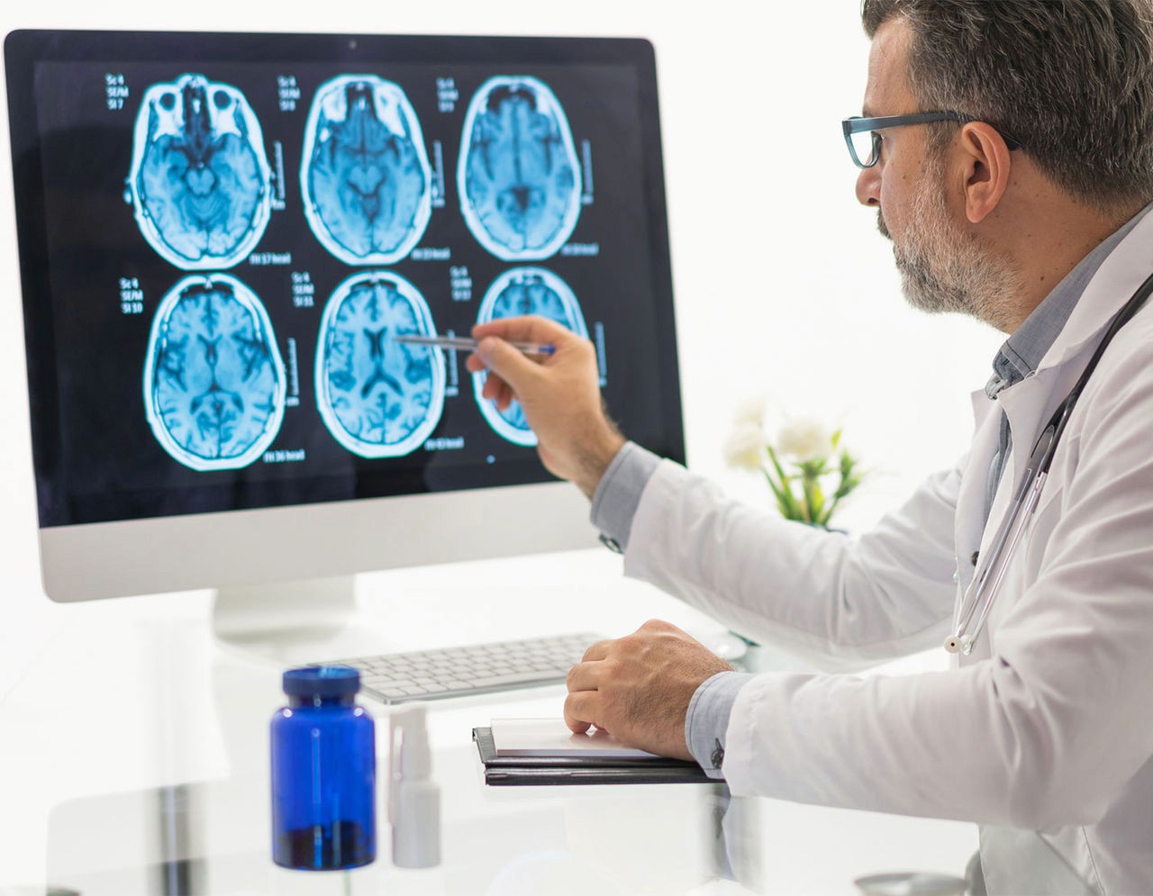 Radiologist reviewing brain MRI scans on a diagnostic workstation