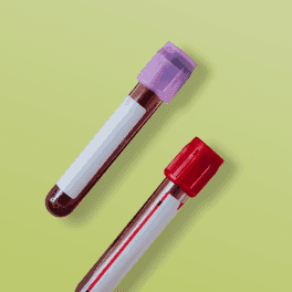 test tubes with blood