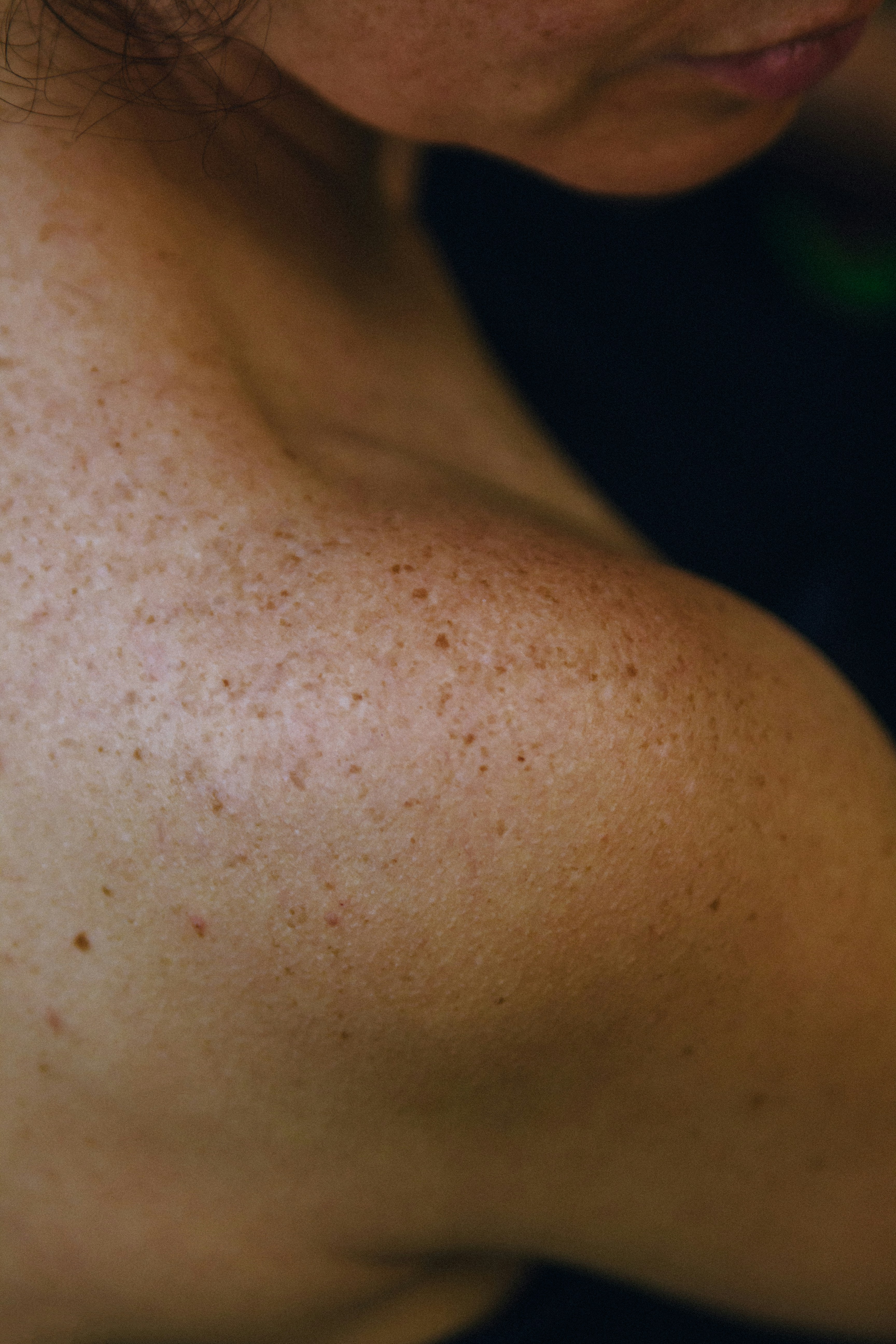 A close up of a woman with freckles on her arm