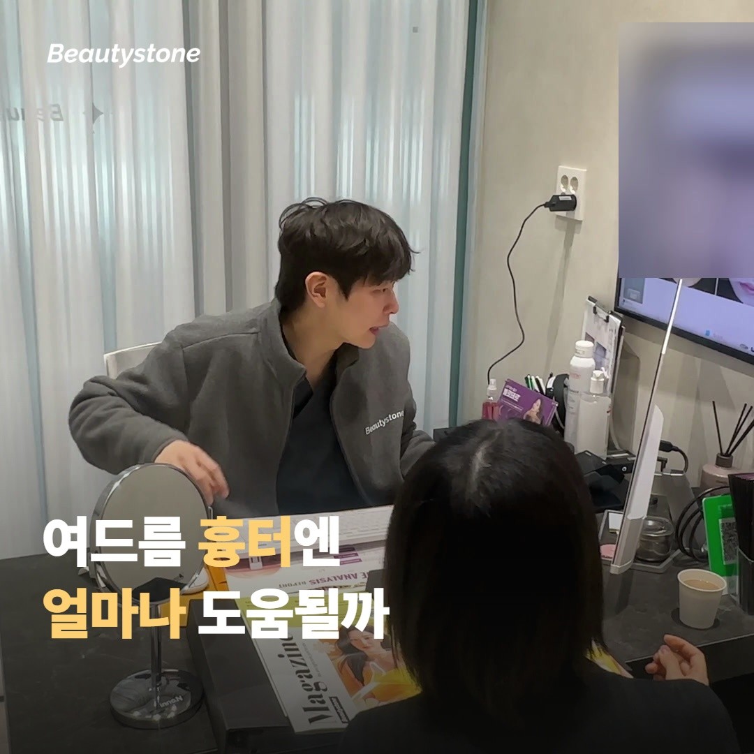 여드름 흉터엔 얼마나 도움이 될까요