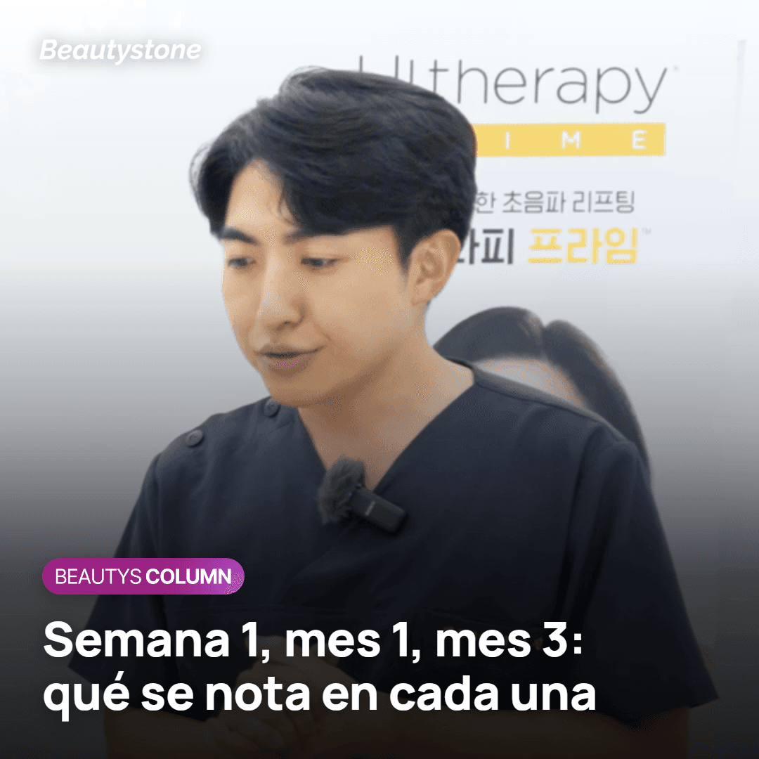 Qué se nota tras Ultherapy en la primera semana, al mes y a los tres meses