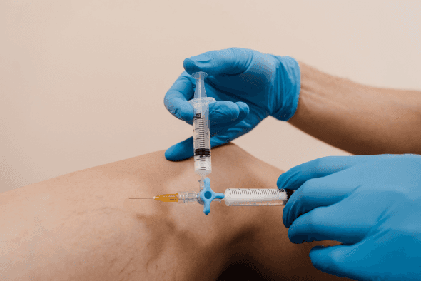 Benefícios da escleroterapia no tratamento de vasinhos