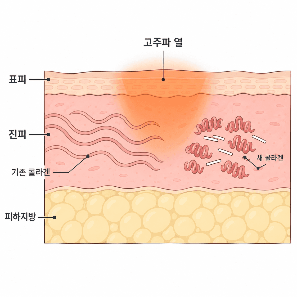 열이 닿는 층과 새로 채워지는 층이 달라요.