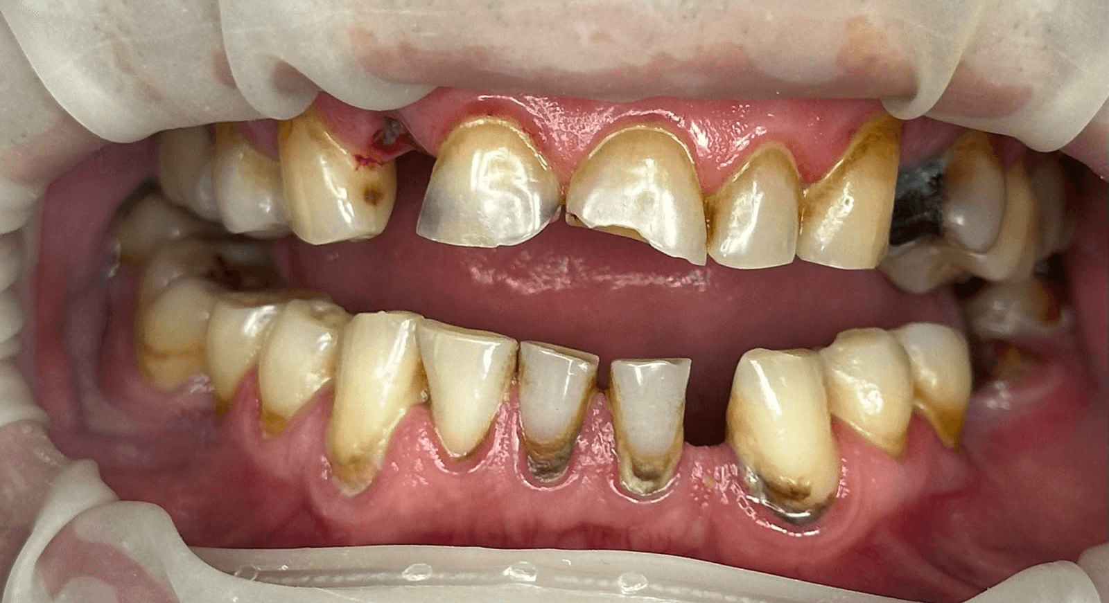 Image after