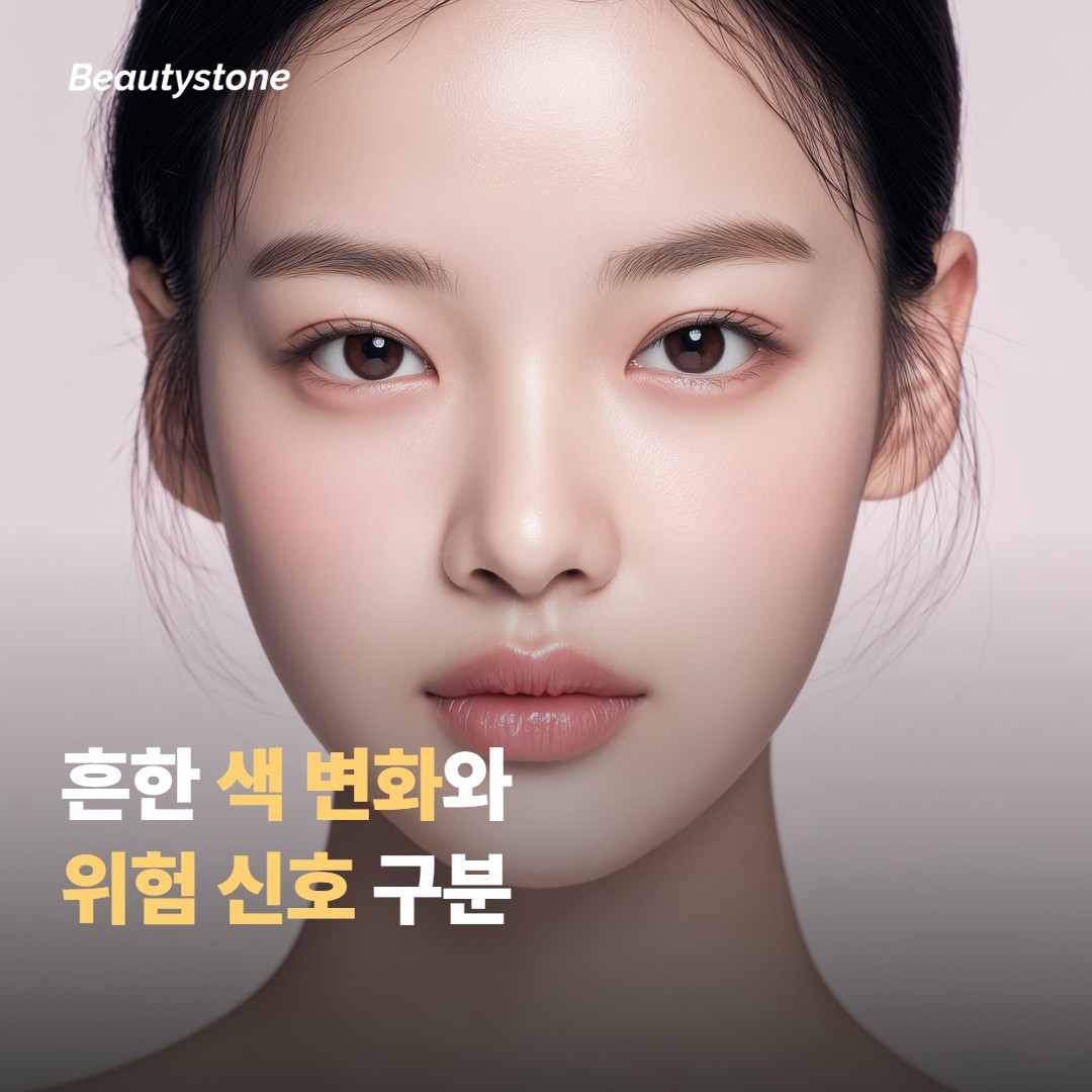 흔한 색 변화와 병원에 연락할 신호 구분하기