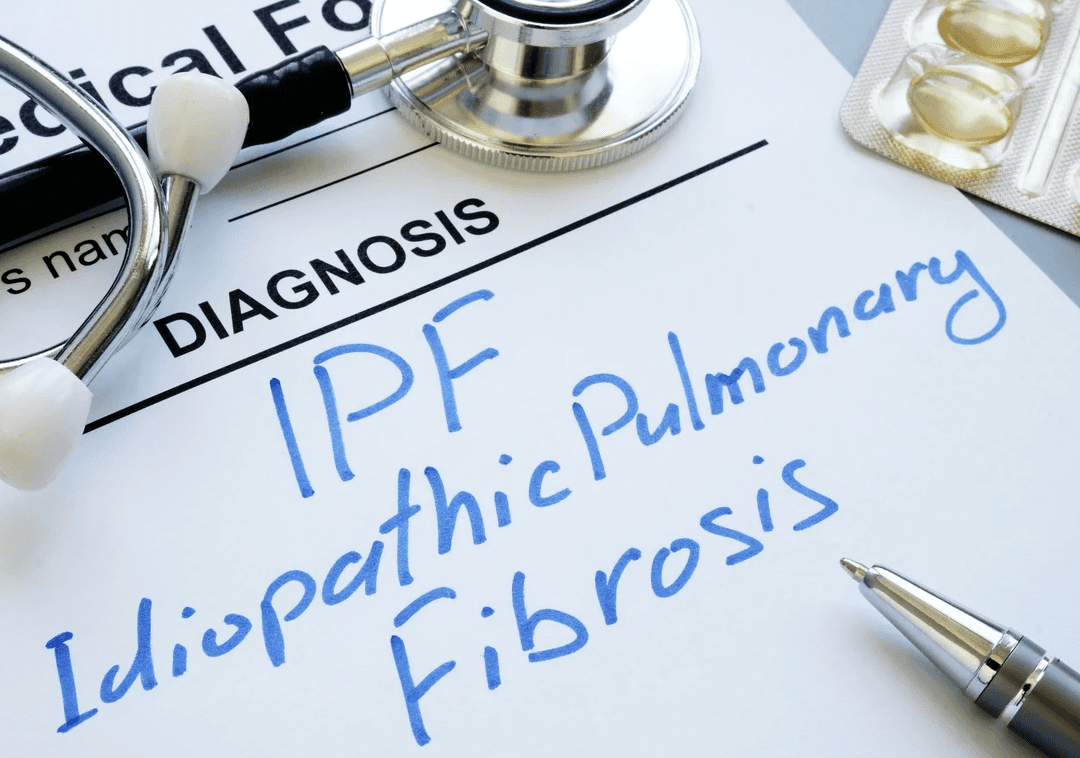 a close up of a plastic model of a human brain