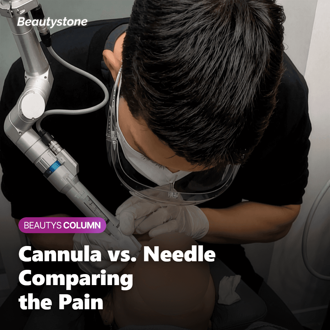 Diagram comparing pain from a cannula versus a needle