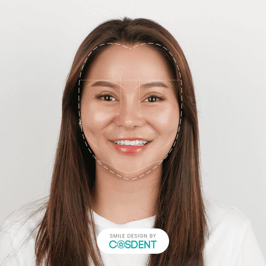 หน้ารูปหัวใจ ยิ้มกว้าง 20 ซี่