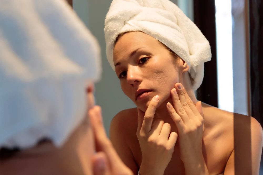 Woman examining facial skin issues before med spa visit.