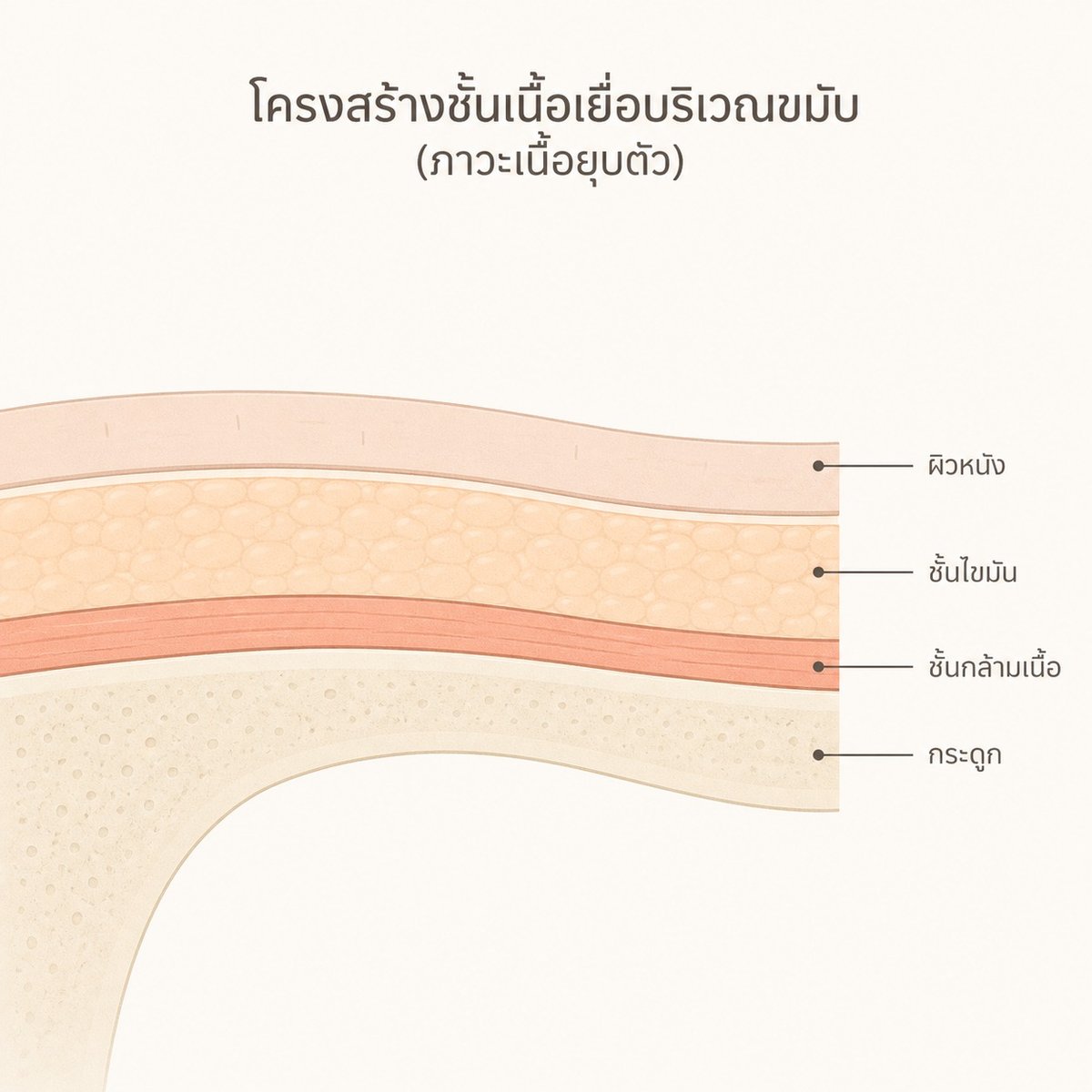 ภาพตัดขวางบริเวณขมับ แสดงชั้นผิวหนัง ไขมัน กล้ามเนื้อ และกระดูกที่บางลงพร้อมกัน