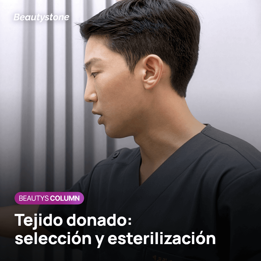 Control del tejido donante de Re2O y su efecto en el precio