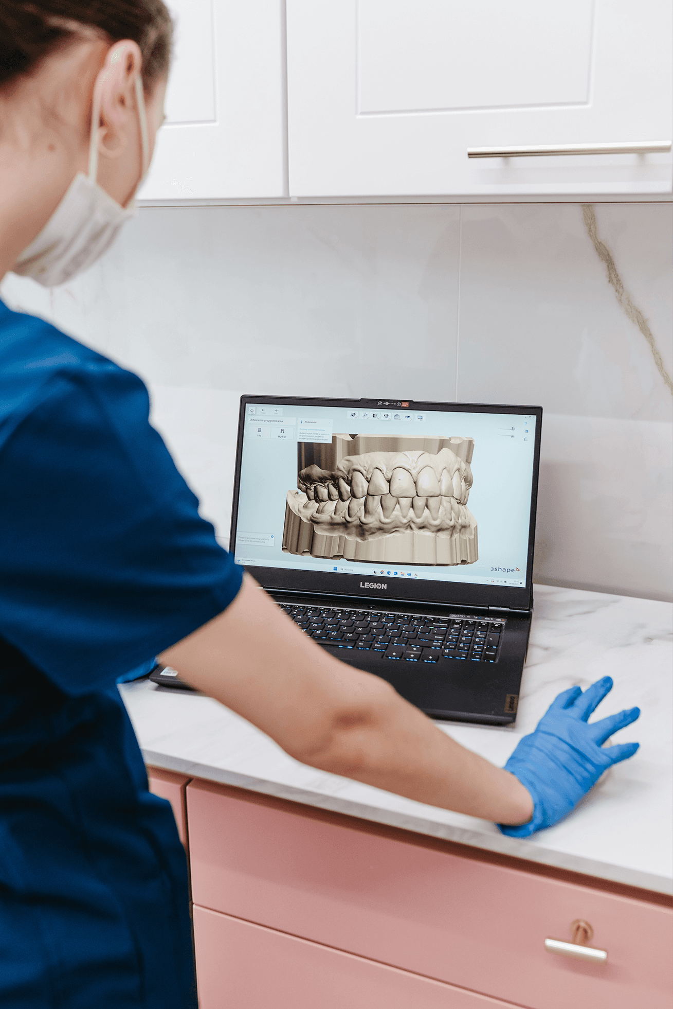 Wizualizacja implantów.