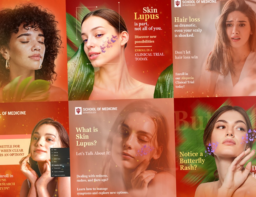 Indiana University (Dermatology) - Social Media Designs